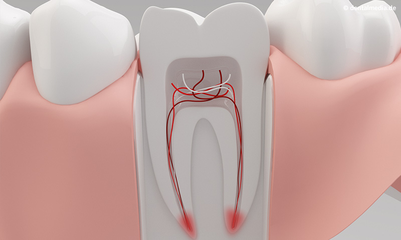 endodontie